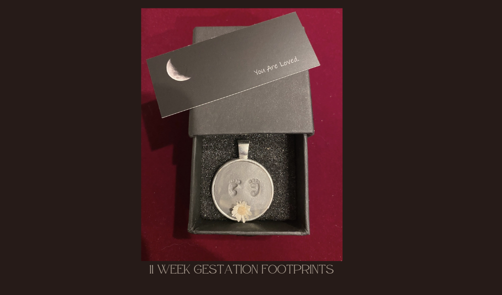 11 week gestation fetus footprints