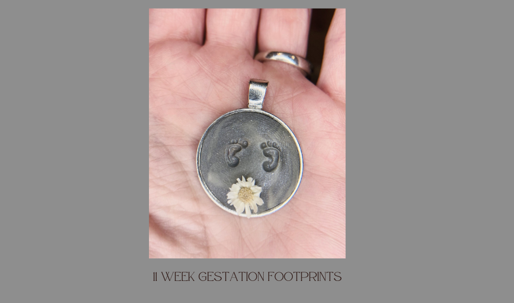 11 week gestation fetus footprints