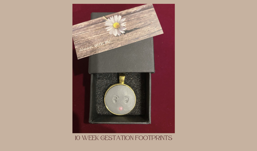 10 week gestation fetus footprints
