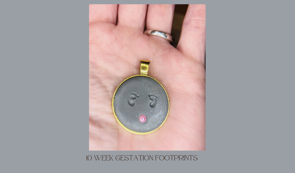 10 week gestation fetus footprints