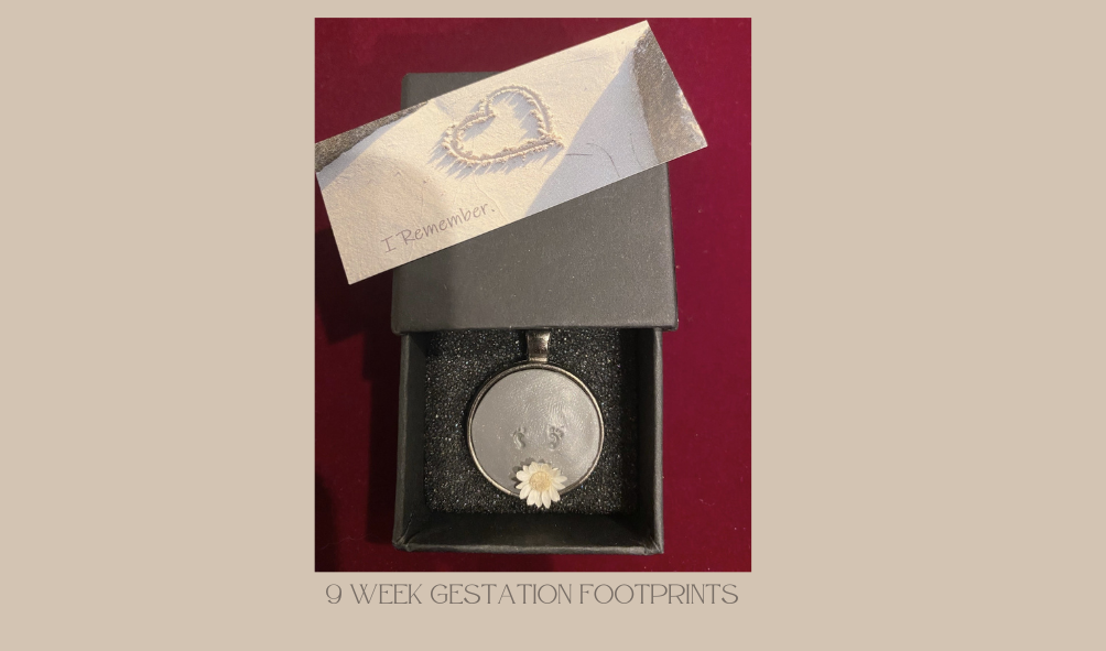 8 week gestation fetus footprints